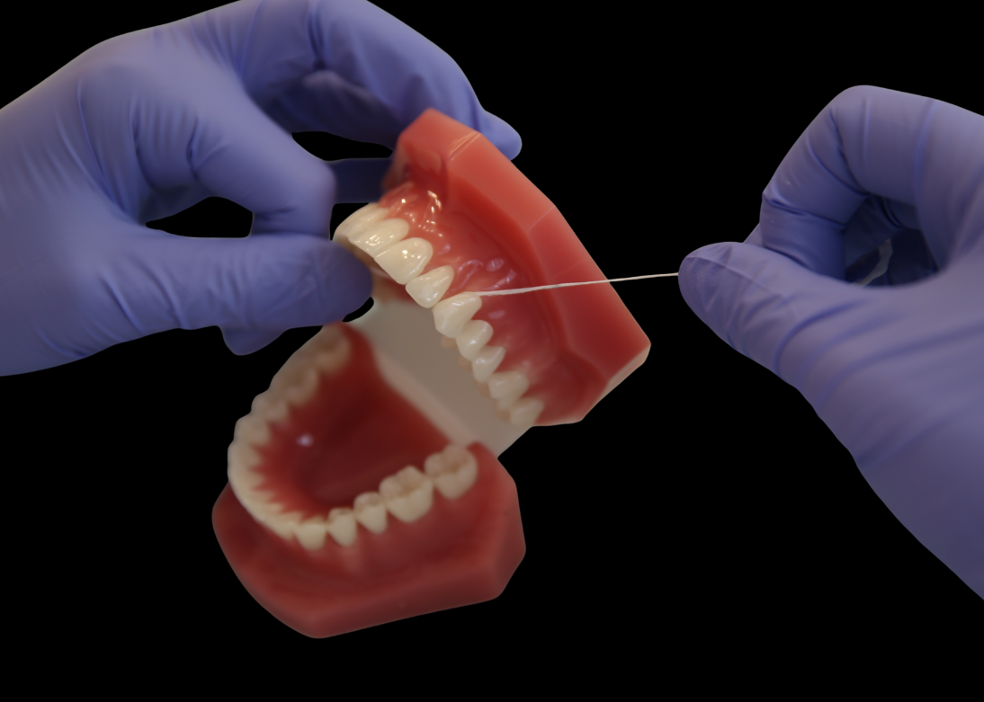 Removable Dentures